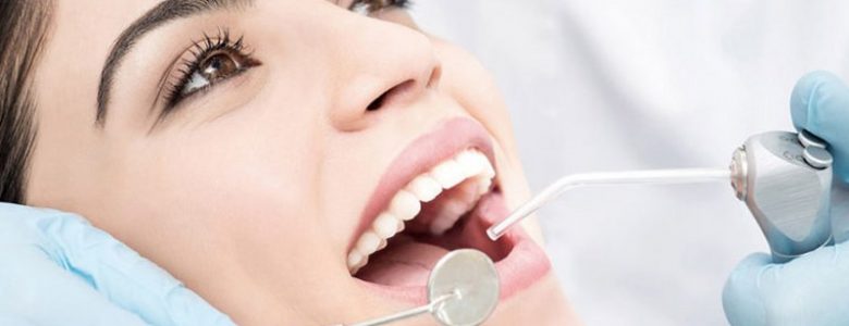 endodonzia-trattamenti-768x400_800x417